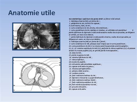 Apport De Larthroscanner Dans La Pathologie Du Genou