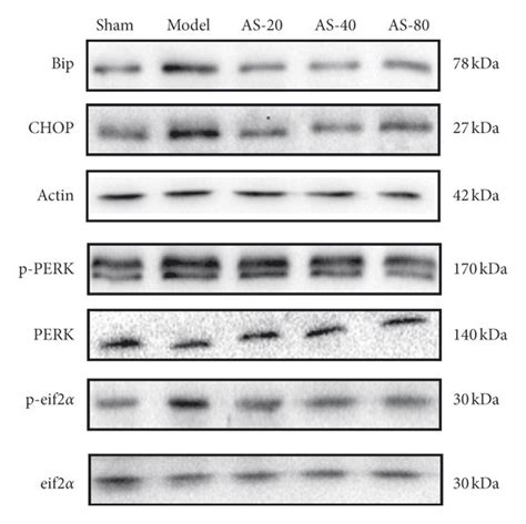 Western Blot Analysis Of Er Stress Related Proteins P Perk P Eif2α Download Scientific