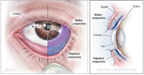 Abnormalities Of The Conjunctiva Sclera Flashcards Quizlet