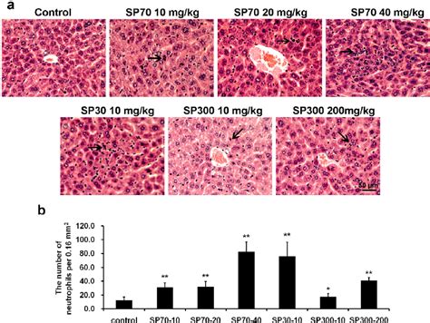 Neutrophils Infiltration Was Observed In Histopathological Examinations