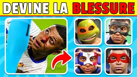 Devine qui PLEURE Blessures de Footballeurs Kylian Mbappé