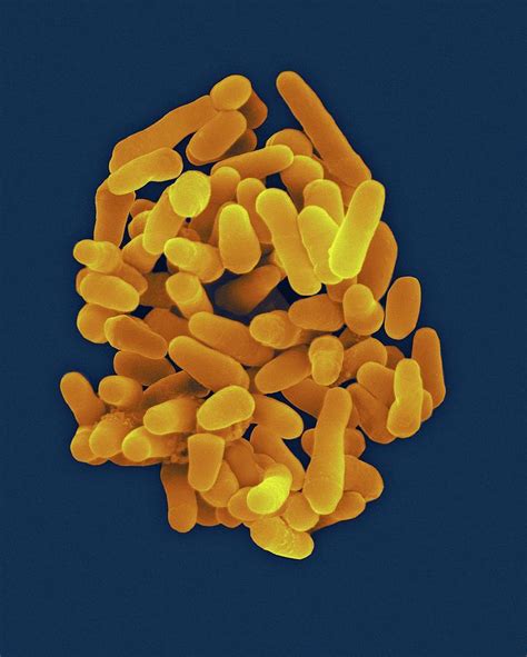 Mycobacterium Tuberculosis Photograph by Dennis Kunkel Microscopy ...