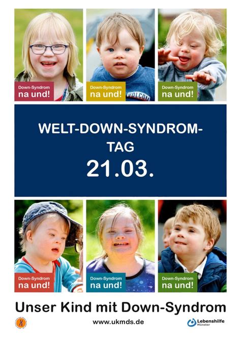 Unser Kind mit Down Syndrom Trisomie 21 Elterngruppe für Münster und