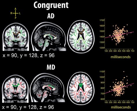 Relationship Between MRT In The Congruent Condition And Diffusion