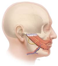 Functional Free Muscle Flap Facial Paralysis Surgery & Functional Restoration | Houston, Texas USA