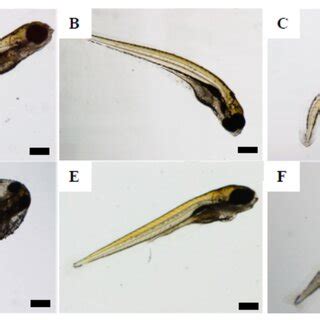 Malformations Found In Exposed Zebrafish Embryos At 120 Hpf A