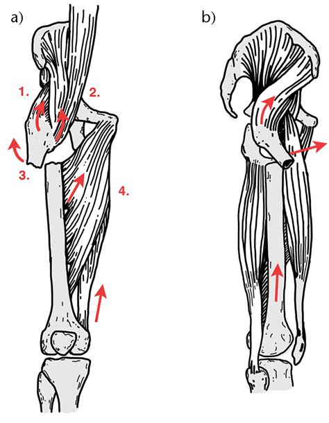 deforming forces red arrows   proximal  distal fragments