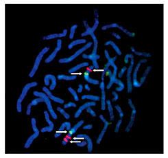 Metaphase Fish Analysis Of The Ior Rch Cell Line With Commercial Probe