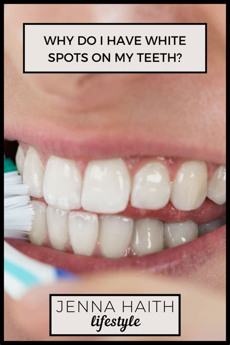 How To Get White Teeth Tips From A Dental Hygienist Jenna Haith