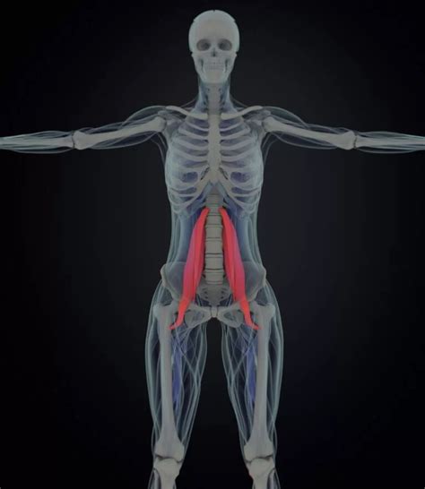 Psoas Syndrome - Cause, Symptoms, Treatment, Exercise