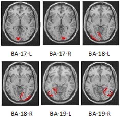 Rois Included The Brodmann Areas Ba 17 18 And 19 Divided Into Left