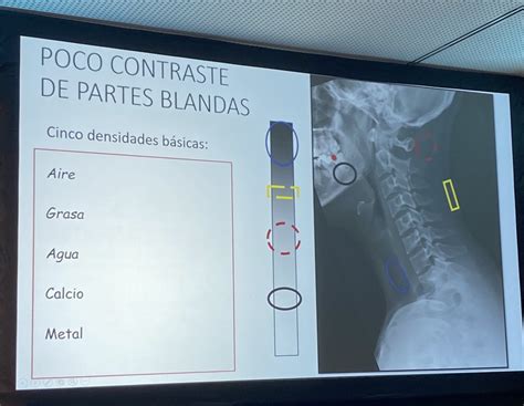 Soc Esp Reumatología on Twitter RT jesussanzsanz44 Seguimos con una