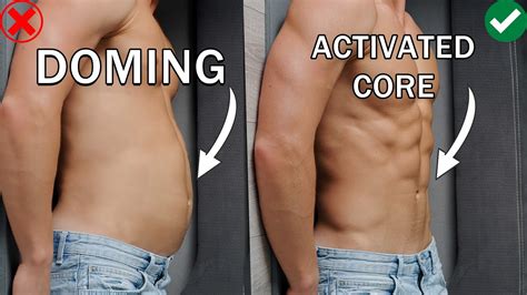 Fix Doming Belly Activate Core And Get A Flat Stomach Youtube