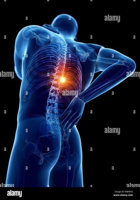 Back pain, computer illustration Stock Photo - Alamy