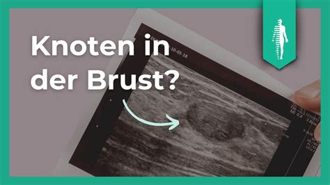 Fibroadenom In Der Brust Das Solltest Du Wissen Diagnose Behandlung