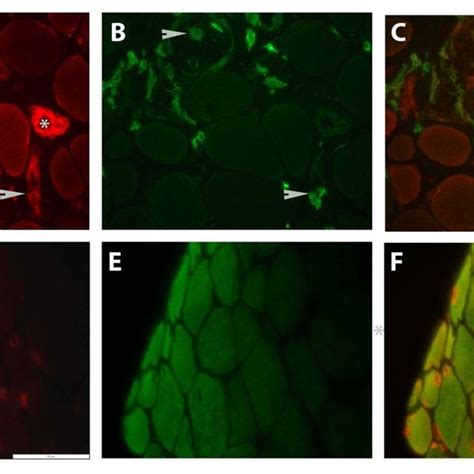 Nf B And Nfat Transcription Factor Families And Their Involvement In