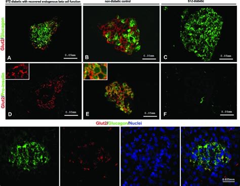 Double GLUT2+/glucagon-positive cells in the pancreas of monkeys with... | Download Scientific ...