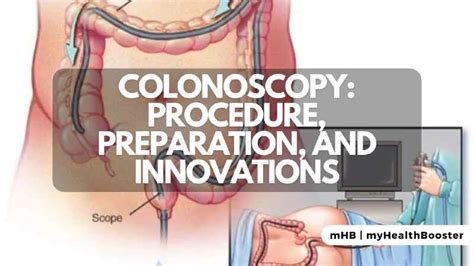 Colonoscopy: Procedure, Preparation, and Innovations – MyHealthBooster