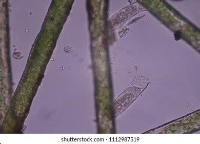 Water Microorganism Under Microscope Stock Photo 1112987519 | Shutterstock