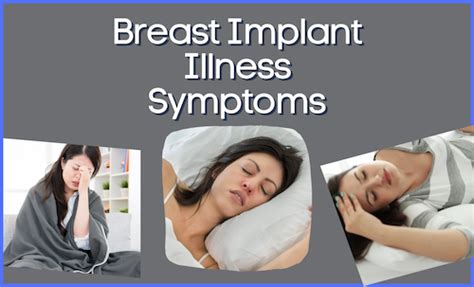 Breast Implant Illness Symptoms Pain Swelling Solutions