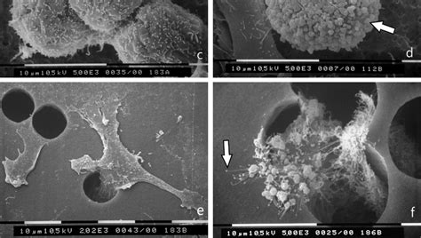 3D Matrigel 0 18 μg mL cell cultures as observed at SEM a MCF 7