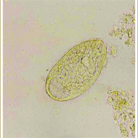 Cycle De Balantidium Coli Download Scientific Diagram