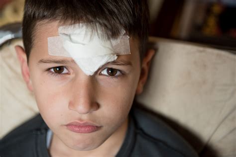 Kids and head injuries