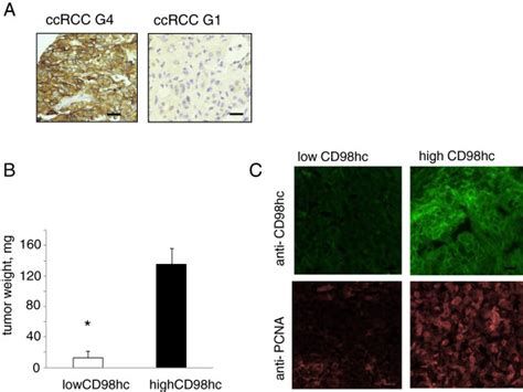 Cd Hc Slc A Drives Integrin Dependent Renal Cancer Cell Behavior Pmc