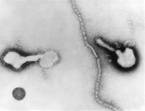 Human Parainfluenza Viruses המכלול