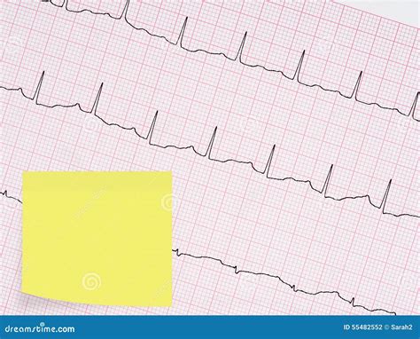 Electrocardiogram Ecg Detail With Blank Sticky Note For Message Stock