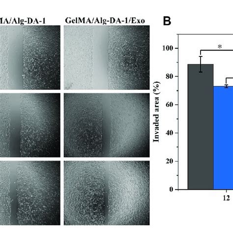 Wound Healing Assay To Test Migration Ability Of Lo2 Cells Treated With