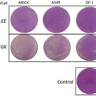 The Comparison Of Plaque Formation Mdck A And Df Cells Were