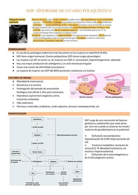Res Menes De S Ndrome De Ovario Poliqu Stico Descarga Apuntes De