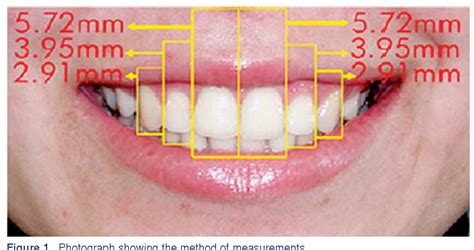 Figure From Geometric And Mathematical Proportions And Their