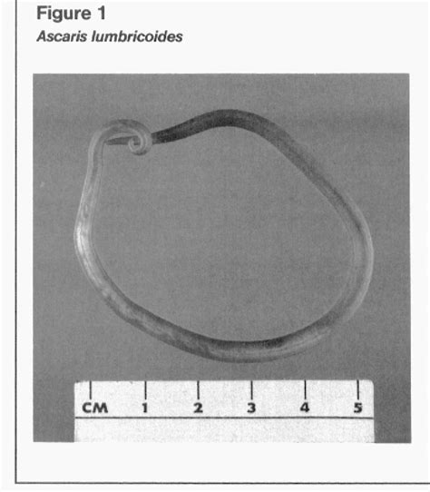 Ascaris Lumbricoides Preparation Semantic Scholar