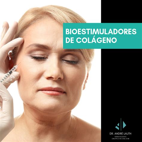 O Que Bioestimulador De Col Geno Dr Andr Lauth Dermatologista