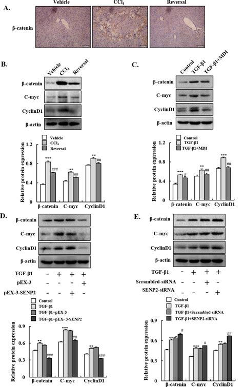 Figure 1 From Senp2 Alleviates Ccl4 Induced Liver Fibrosis By Promoting