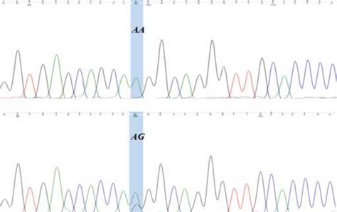 Dna Sequencing Electropherogram Of Ag Rs369703243 In Intron 7 Of The Download Scientific