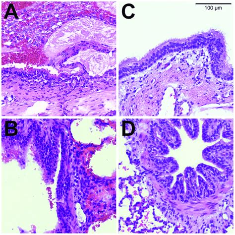 Histology Representative Histology Images Taken From A Lung Following