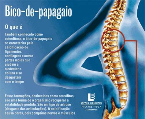 Total 42 Imagem Exercicios Para Coluna Bico De Papagaio Br