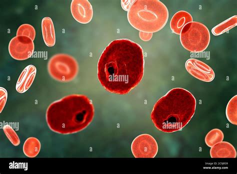 Plasmodium Ovale Trophozoite Fotografías E Imágenes De Alta Resolución Alamy