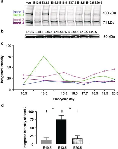 Distribution Of Disc1 Expression In The Developing Embryonic Mouse