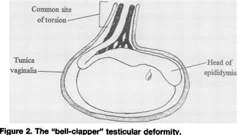 Figure 2 From Scrotal Pain Semantic Scholar