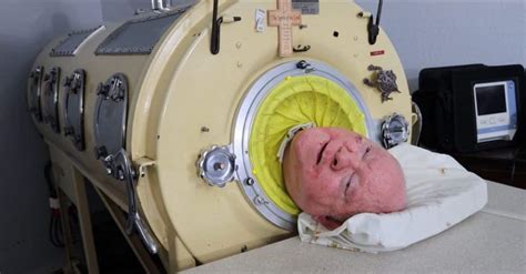 Paul Alexander Polio Paul Who Lived In Iron Lung For 70 Years Dies At 78