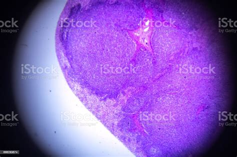 Lymph Node Cross Section In Microscopy Stock Photo Download Image Now