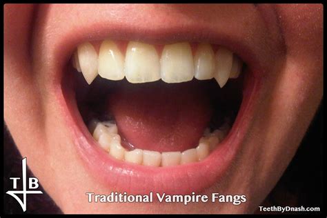 Traditional Vampire Teeth By Dnash