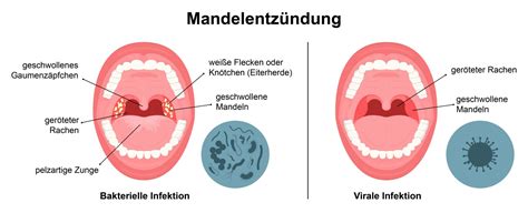 Mandelentz Ndung Schwabe Austria