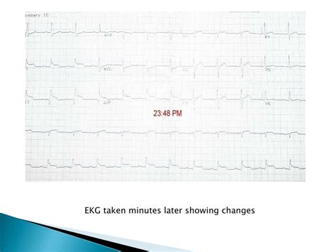 Ppt Endocarditis Pericarditis Powerpoint Presentation Free Download