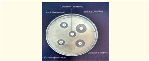 Antibiotic Susceptibility Test For Staphylococcus The Susceptibility