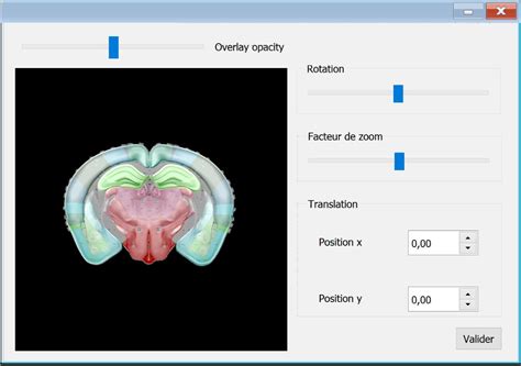 Traitement De L Autoradiographie Avec Atlas Reactiv Ip